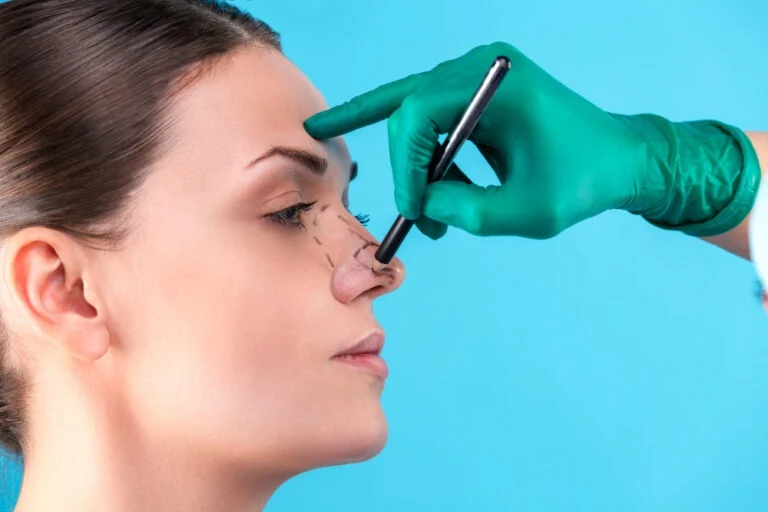 نکاتی درباره جراحی پلاستیک بینی گوشتی
