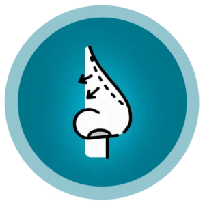 جراحی بینی