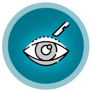 جراحی پلک