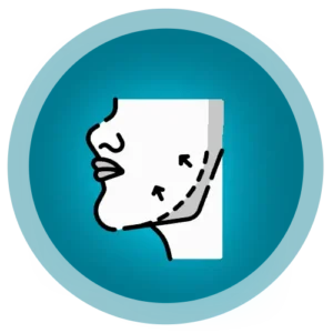 پروتز چانه و گونه