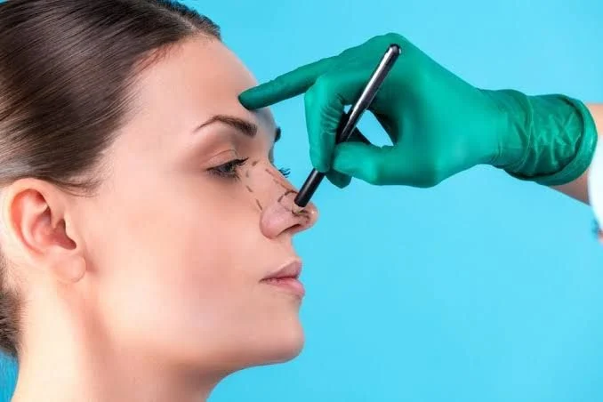 جراحی پلاستیک بینی؛ نکات قبل و بعد از عمل