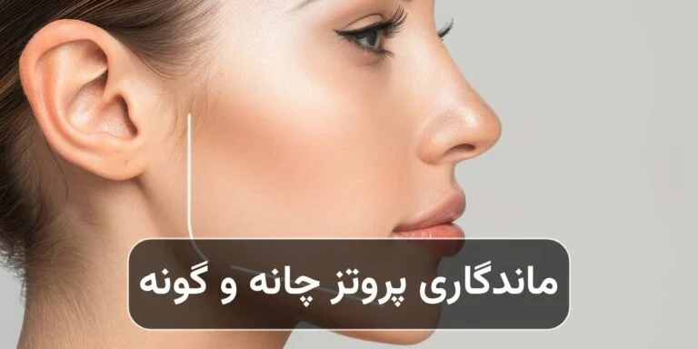 ماندگاری پروتز چانه و گونه چقدر است؟