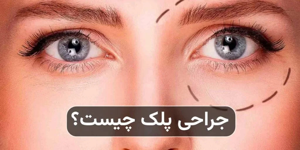 جراحی پلک چیست و چه مشکلاتی را درمان می‌کند؟