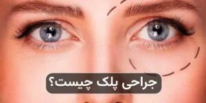جراحی پلک چیست و چه مشکلاتی را درمان می‌کند؟