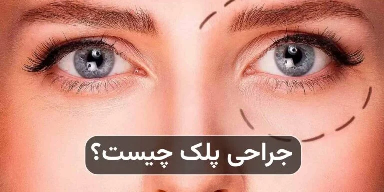 جراحی پلک چیست و چه مشکلاتی را درمان می‌کند؟
