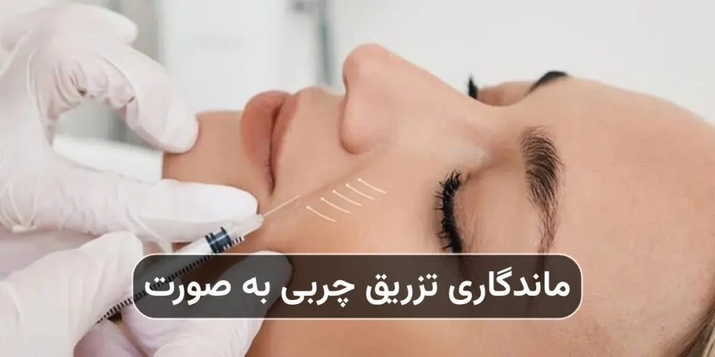 ماندگاری تزریق چربی به صورت