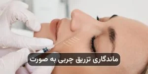 ماندگاری تزریق چربی به صورت