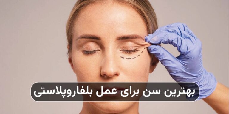 بهترین سن برای عمل بلفاروپلاستی