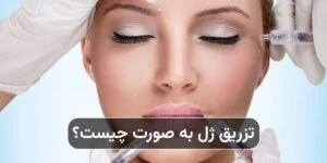 تزریق ژل به صورت چیست