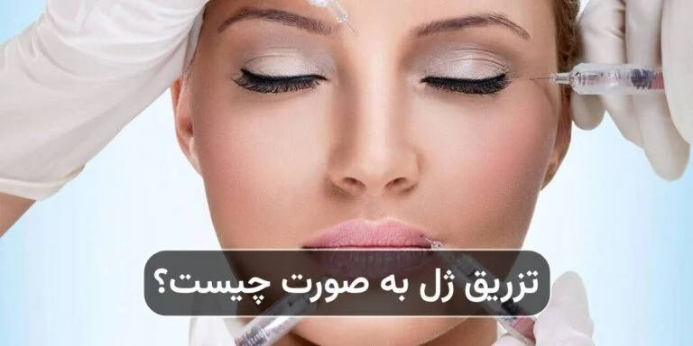 تزریق ژل به صورت چیست و چه کاربردهایی دارد؟
