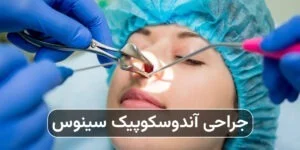 جراحی آندوسکوپیک سینوس چیست