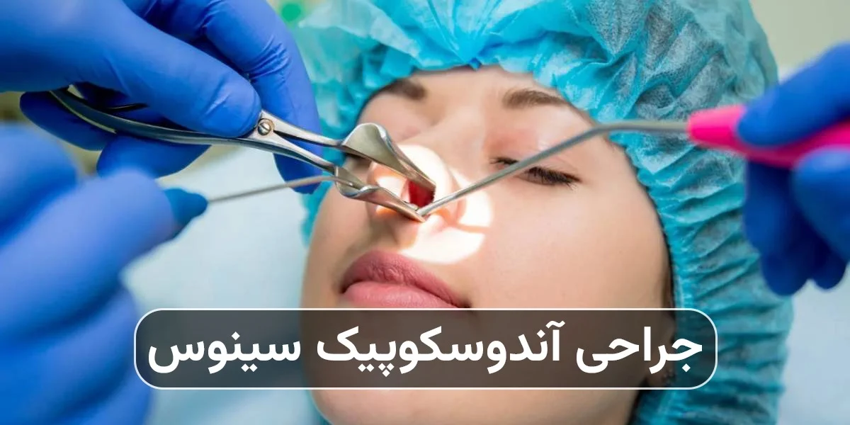 جراحی آندوسکوپیک سینوس چیست
