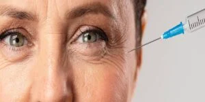 تزریق بوتاکس در خطوط پنجه کلاغی