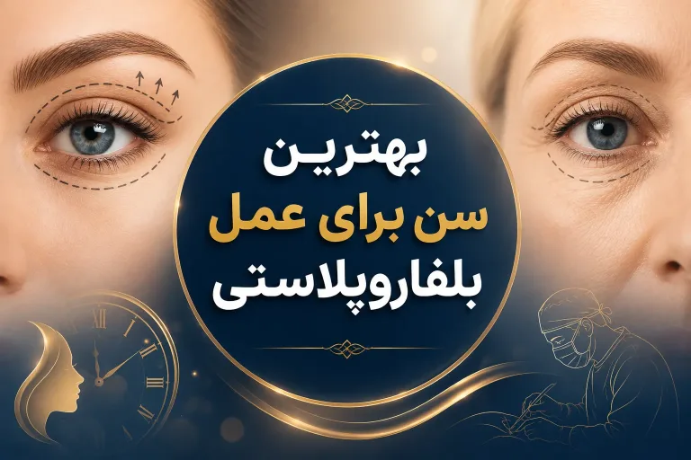 بهترین سن برای عمل بلفاروپلاستی