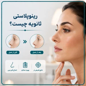 رینوپلاستی ثانویه چیست؟