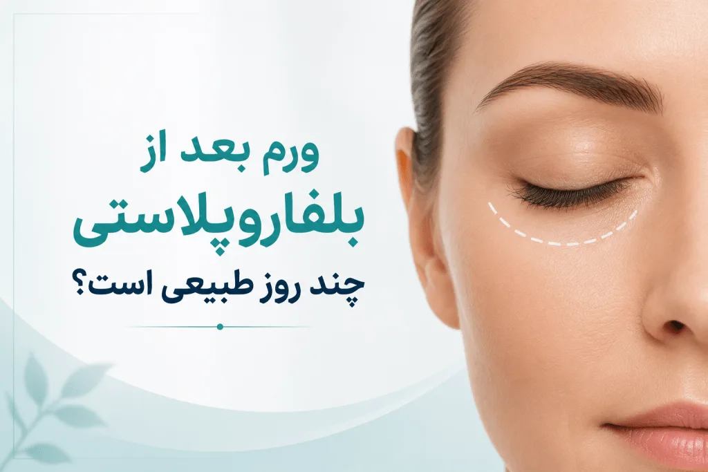 ورم بعد از بلفاروپلاستی چند روز طبیعی است؟