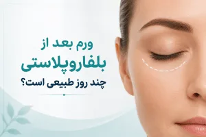 ورم بعد از بلفاروپلاستی چند روز طبیعی است؟