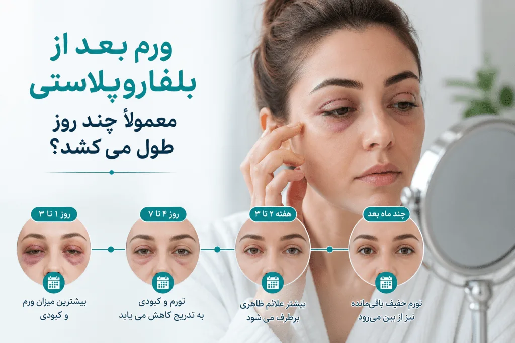 ورم بعد از بلفاروپلاستی معمولاً چند روز طول می‌کشد؟