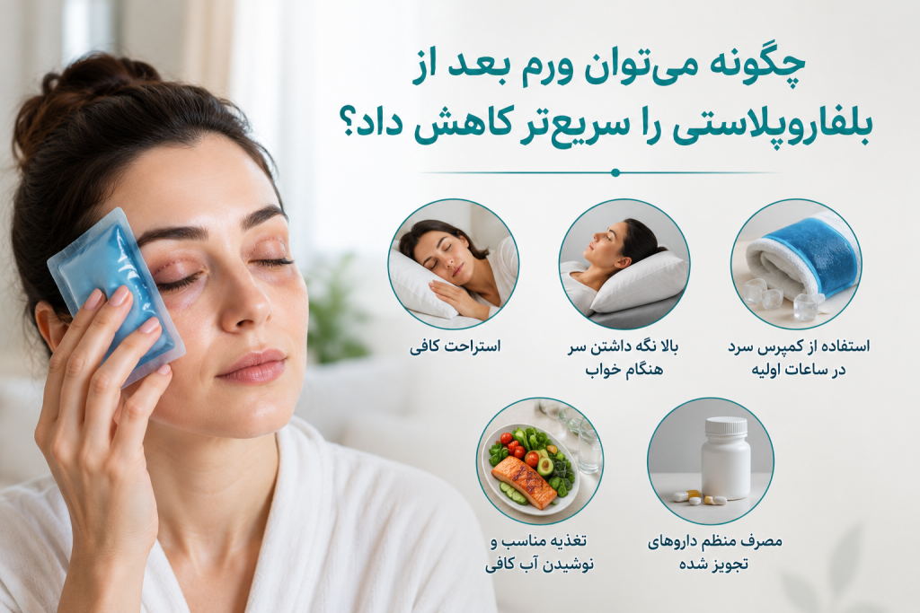 چگونه می‌توان ورم بعد از بلفاروپلاستی را سریع‌تر کاهش داد؟