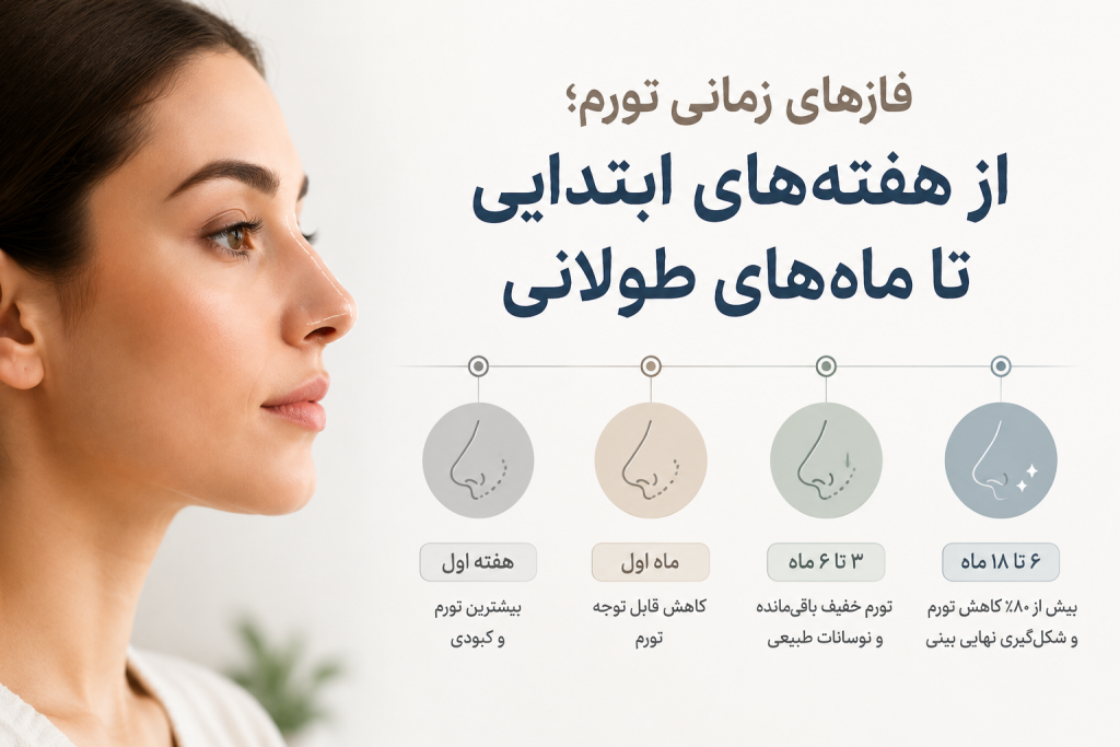 ورم بعد از جراحی بینی چند ماه طول می‌کشد؟