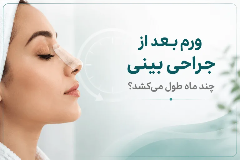 ورم بعد از جراحی بینی؛ 6 عامل مؤثر بر مدت ماندگاری تورم