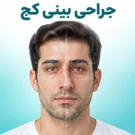 عکس شماتیک آقا با بینی کج
