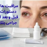 مراقبت‌ها و دستورات قبل و بعد از جراحی پلک